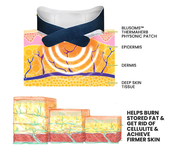 Blusoms™ ThermaHerb Physonic Patch